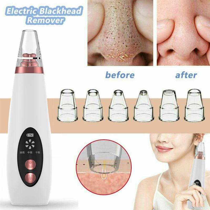 Blackhead Remover Face Pore Vacuum Skin Care Acne Pore Cleaner Pimple Removal Vacuum Suction Facial Tools USB Rechargeable